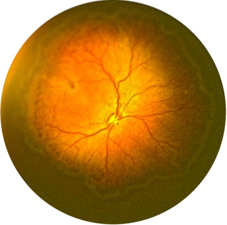 Ultra-widefield retinal image