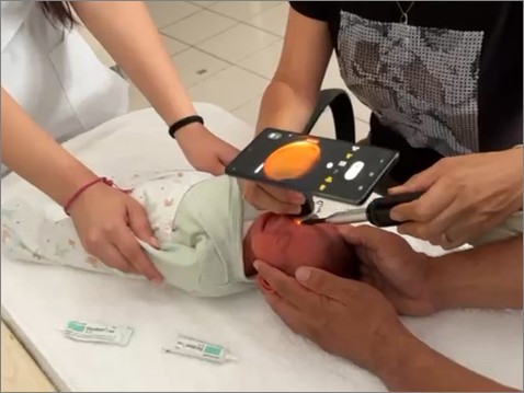 PedCam-SP in use